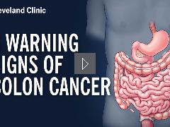 6 Warning Signs of Colon Cancer