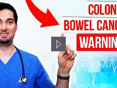 Colon cancer symptoms and signs of bowel cancer